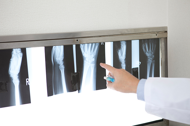 医師がレントゲン写真を見ながら骨の状態を確認する様子