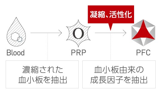 血液からPRPを経てPFC(血小板由来成長因子)を抽出する工程を示した図